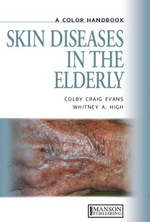 کتاب لاتین بیماری های پوستی در افراد مسن: راهنمای رنگی (2012)