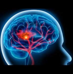 شخصیت پس از بروز یک سکتۀ مغزی